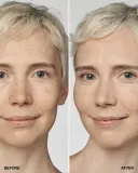 Clinique Even Better Clinica Serum Foundation - Тональная основа с защитой SPF 20 оттенок CN 08 Linen, 30 ml — фото 3