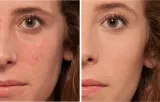 L’Oreal Paris True Match The One - Корректор в жидкости, 6 мл, оттенок 1.R/C Rose Ivory — фото 3