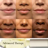 fresh Sugar Advanced Therapy Treatment Lip Balm - Увлажняющий бальзам для губ, 4 g — фото 3