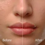 fresh Sugar Treat Lip Oil - Бальзам для губ ограниченного издания. оттенок Honey, 4 ml — фото 4
