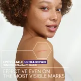 A-Derma Epitheliale A.H. Ultra - Обновляющий крем для раздраженной кожи, 40 ml — фото 4