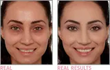 IT Cosmetics Bye Bye Under Eye - Корректор против старения, 12 мл, оттенок 25 Medium Natural — фото 3