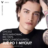 Vichy Dercos Anti-Dandruff - Шампунь против перхоти для нормальных и склонных к жирности волос — фото 7