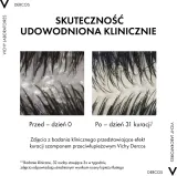 Vichy Dercos Anti-Dandruff - Шампунь против перхоти для нормальных и склонных к жирности волос — фото 8