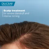 Ducray Kelual DS Treatment Shampoo - Шампунь против перхоти, ухаживающий, 100 мл — фото 2