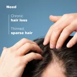 Ducray Anaphase+ Anti-Hair Loss Anti-Thinning Shampoo - Шампунь для укрепления и оживления волос против выпадения — фото 3