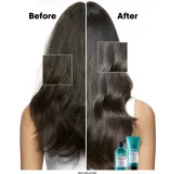 L’Oreal Professionnel Serie Expert Scalp Advanced - Шампунь для чувствительной и раздраженной кожи головы — фото 3