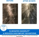 Uriage DS HAIR Anti-Dandruff Treatment Shampoo - Шампунь против перхоти для раздраженной кожи головы — фото 4