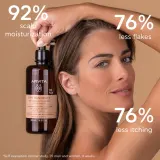 Apivita Dandruff Dry Dandruff Shampoo - Шампунь против перхоти — фото 5