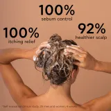 Apivita Dandruff Oily Dandruff Shampoo - Шампунь против перхоти для жирных волос, 250 мл — фото 4