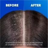Head & Shoulders Classic Clean 2in1 - Шампунь против перхоти 2 в 1 — фото 6