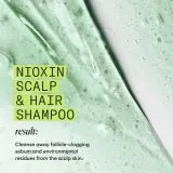 Nioxin System 2 Scalp + Hair Shampoo - Шампунь против выпадения волос, 1000 мл — фото 2