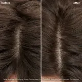 Biolage ScalpSync - Легкий кондиционер, 200 мл — фото 2
