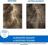Uriage DS HAIR Kerato-Reducing Treatment Shampoo - Шампунь для чувствительной и раздраженной кожи с кераторедукцией, 150 мл — фото 4