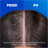 Head & Shoulders Menthol Fresh 2in1 - Шампунь с кондиционером 2в1 против перхоти — фото 5