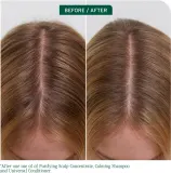 Biolage ScalpSync - Концентрат для кожи головы, 200 мл — фото 4
