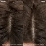 Biolage ScalpSync - Шампунь против перхоти, 250 мл — фото 2