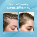 Living Proof Scalp Care - Сыворотка, стимулирующая рост новых волос, 50 мл — фото 7