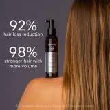 Apivita Tonic Hair Loss Lotion - Спрей против выпадения волос, 150 мл — фото 3