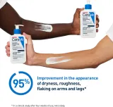 CeraVe Moisturizers Intensive Moisturizing Lotion - Млечко увлажняющее для сухой и зудящей кожи — фото 3