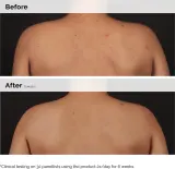 The Ordinary Salicylic Acid 0.5% Body Serum - Улучшающее сыворотка для тела с салициловой кислотой, 240 мл — фото 5