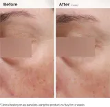 The Ordinary Niacinamide 5% Face & Body Emulsion - Легкий увлажняющий крем против пигментации na twarz i ciało, 100 мл — фото 5