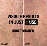 Neutrogena Norwegian Formula Intense Repair - Подарочный набор для мгновенного восстановления, 2 шт — фото 3