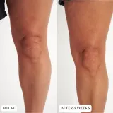 Perricone MD High Potency Intensive Body Therapy - Интенсивное питательное молочко для тела, 177 мл — фото 7