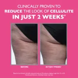 Peter Thomas Roth FIRMx Tight & Toned - Укрепляющий крем против целлюлита для тела, 100 мл — фото 3