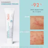 Avene Cleanance Comedomed Peeling - Интенсивный крем против несовершенств кожи с акне, 40 мл — фото 4
