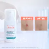 Avene Cleanance Comedomed+ - Интенсивный уход против несовершенств кожи с акне, 30 мл — фото 3