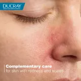Ducray Kelual DS Soothing Cream - Успокаивающий крем для сухой и поврежденной кожи, 40 мл — фото 2