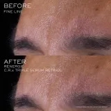 Lancome Renergie CRX Triple Serum Retinol - Сыворотка для лица — фото 4
