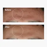 The Ordinary Niacinamide 10% + Zinc 1% - Сыворотка для лица, придающая сияние — фото 6