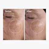The Ordinary Glycolic Acid 7% Exfoliating Toner - Тоник для лица с эффектом отшелушивания и очищения — фото 6