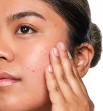 The Ordinary Salicylic Acid 2% Solution - Сыворотка с салициловой кислотой, 30 мл — фото 5