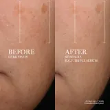Lancome Renergie H.C.F. Triple Serum - Сыворотка для лица — фото 4