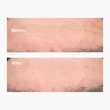 The Ordinary Hyaluronic Acid 2% + B5 - Сыворотка увлажняющая с керамидами — фото 7