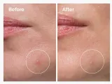 The Ordinary Sulfur 10% Powder-to-Cream Concentrate - Антивоспалительный уход за проблемной кожей, 5 г — фото 3