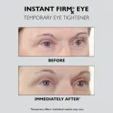 Peter Thomas Roth Instant FIRMx Eye - Крем для глаз для омоложения кожи — фото 2