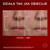 Крем для лица L’Oreal Paris Revitalift Laser дневной, против морщин, с гиалуроновой кислотой, 50 мл — фото 3