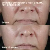 Clinique Smart Clinical Repair Wrinkle Correcting Cream - Питательный крем против морщин — фото 3