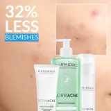 Dermedic Normacne Preventi - Увлажняющий матирующий уход для жирной и комбинированной кожи, 40 мл — фото 6