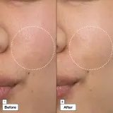 Dr. Jart+ Cicapair Intensive Soothing Repair Cream - Крем интенсивно уменьшающий покраснения, 50 мл — фото 5