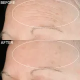 StriVectin Anti-Wrinkle SD Advanced Plus - Концентрированный крем, уменьшающий морщины — фото 2