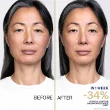 Shiseido Vital Perfection LiftDefine Radiance Night Concentrate - Сыворотка для лица с лифтинг-эффектом на ночь, 40 мл — фото 3