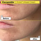 Dr. Jart+ Ceramidin Ectoin-Infused Cream - Увлажняющий крем для лица с керамидами, 50 мл — фото 3