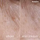 Biotherm Blue Peptides Eyes Lips Contour Reshaper - Уход за областью вокруг глаз и губ, 15 мл — фото 5