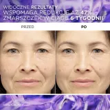 L’Oreal Paris Revitalift Filler - Сыворотка против морщин с гиалуроновой кислотой — фото 4