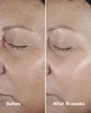 Clinique Smart Clinical Repair Wrinke Correcting Serum - Сыворотка для лица, корректирующая морщины — фото 3